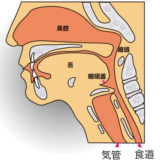 誤嚥性肺炎1.jpg