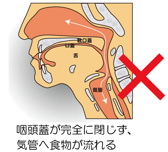 뚋x3.jpg