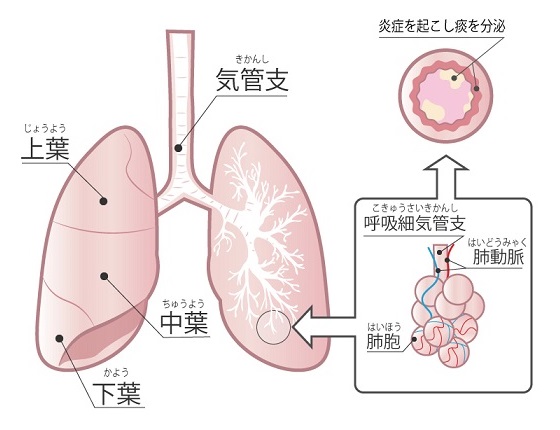 痰 が 絡む 原因