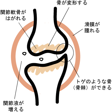 20131218--hiza2.png