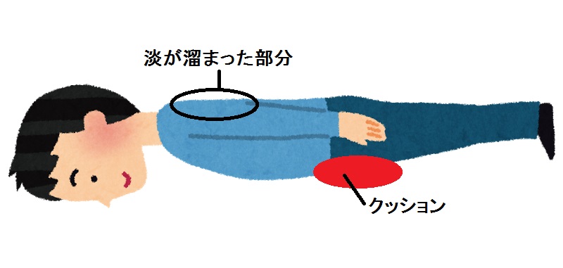 ドレナージ 体位 体位ドレナージの効果と注意点、看護について｜ハテナース