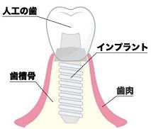 口腔ケアまとめ2.jpg